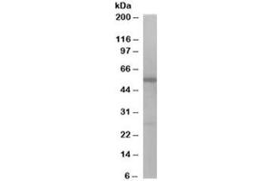 Western blot testing of Jurkat lysate with DBNL antibody at 1ug/ml. (DBNL 抗体)