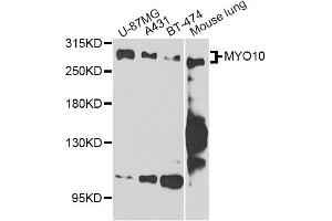 Western blot analysis of extracts of various cell lines, using MYO10 antibody. (Myosin X 抗体)