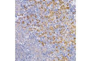 Immunohistochemistry of paraffin-embedded mouse brain using Symmetric DiMethyl-Histone H4-R3 Rabbit pAb (ABIN3017488, ABIN3017489, ABIN3017490, ABIN1680265 and ABIN6220116) at dilution of 1:100 (40x lens). (Histone H4 抗体  (2meArg3))