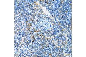 Immunohistochemistry of paraffin-embedded mouse spleen using UBE2D1 antibody (ABIN5971011) at dilution of 1/100 (40x lens). (UBE2D1 抗体)