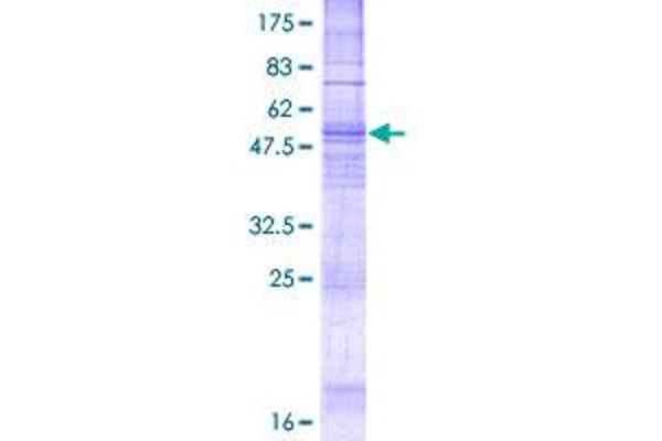 TACR1 Protein (AA 1-311) (GST tag)