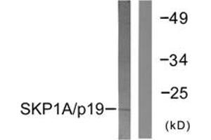 Western blot analysis of extracts from COS7 cells, using SKP1A/p19 Antibody. (SKP1 抗体  (AA 41-90))