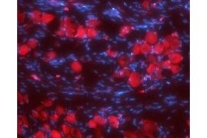 Expression of Synaptophysin in rat DRG - Immunohistochemical staining of rat dorsal root ganglia (DRG) frozen sections using Anti-Synaptophysin Antibody (ABIN7043791, ABIN7044656 and ABIN7044657), (1:100). (Synaptophysin 抗体  (Intravesicular Loop))