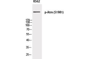 Western Blotting (WB) image for anti-Ataxia Telangiectasia Mutated (ATM) (pSer1981) antibody (ABIN5955782) (ATM 抗体  (pSer1981))