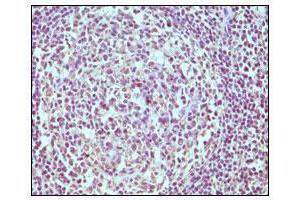 Immunohistochemical analysis of paraffin-embedded human normal lymph node, showing cytoplasmic localization using CD19 mouse mAb with DAB staining. (CD19 抗体)