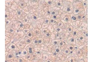 DAB staining on IHC-P; Samples: Human Liver Tissue (PLGF 抗体  (AA 43-162))