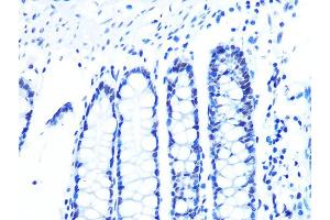 Immunohistochemistry of paraffin-embedded human colon using U2/U2/U2 Rabbit mAb (ABIN1682786, ABIN3019042, ABIN3019043 and ABIN7101704) at dilution of 1:100 (40x lens). (U2AF2 抗体)