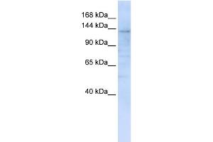 WB Suggested Anti-IMPG2 Antibody Titration:  0. (IMPG2 抗体  (C-Term))