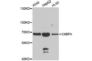 Western blot analysis of extracts of various cell lines, using C4BPA antibody (ABIN5975151) at 1/1000 dilution. (C4BPA 抗体)