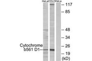 Image no. 1 for anti-Cytochrome B-561 Domain Containing 1 (CYB561D1) (AA 180-229) antibody (ABIN2889869) (CYB561D1 抗体  (AA 180-229))