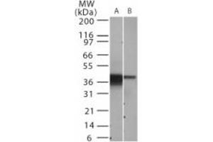 Western Blotting (WB) image for anti-Nuclear Factor of kappa Light Polypeptide Gene Enhancer in B-Cells Inhibitor, alpha (NFKBIA) (Internal Region) antibody (ABIN6655971)