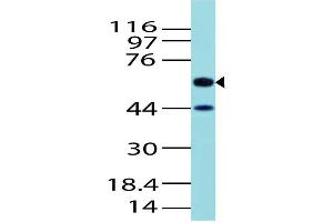 Image no. 1 for anti-Activin A Receptor Type II-Like 1 (ACVRL1) (AA 326-503) antibody (ABIN5027022) (ACVRL1 抗体  (AA 326-503))