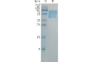 Hepatitis B virus HBSAG Protein, hFc Tag on SDS-PAGE under reducing condition. (HBSAg Protein (AA 2-119) (Fc Tag))