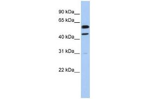 Cyclin B1 antibody used at 1 ug/ml to detect target protein. (Cyclin B1 抗体  (Middle Region))