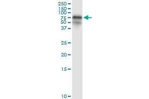 Immunoprecipitation of FGL2 transfected lysate using rabbit polyclonal anti-FGL2 and Protein A Magnetic Bead (FGL2 (人) IP-WB Antibody Pair)