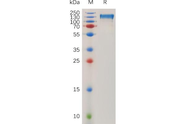 CD51 Protein (AA 31-992) (Fc-His Tag)