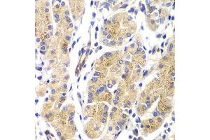 Immunohistochemistry of paraffin-embedded human gastric using HRAS antibody. (HRAS 抗体)