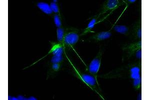 Human astrocytoma cell line CCF-STTG1 was stained with Mouse Anti-Human GFAP-UNLB and DAPI. (GFAP 抗体)