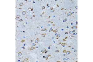 Immunohistochemistry of paraffin-embedded mouse brain using RARS antibody (ABIN5973728) at dilution of 1/100 (40x lens). (RARS 抗体)