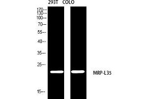 Western blot analysis of 293T COLO using MRP-L35 antibody. (MRPL35 抗体  (AA 80-160))