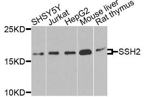 Western blot analysis of extracts of various cell lines, using SSH2 antibody (ABIN6003697) at 1/1000 dilution. (SSH2 抗体)