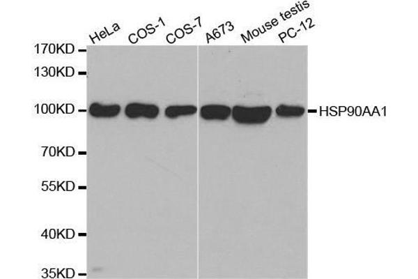 HSP90AA1 抗体  (AA 433-732)