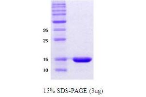 Figure annotation denotes ug of protein loaded and % gel used. (alpha Synuclein DeltaNAC (active) 蛋白)