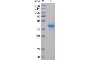 Human BCMA, hFc-His Tag on SDS-PAGE under reducing condition. (BCMA Protein (AA 1-54) (Fc-His Tag))