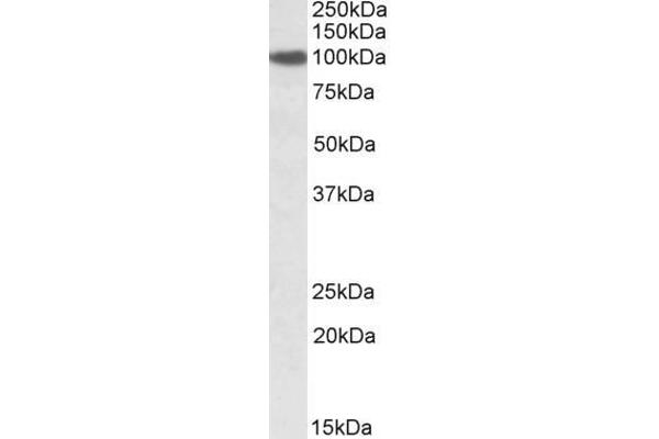 SEC23A 抗体  (Internal Region)