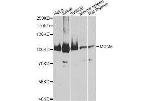 Western blot analysis of extracts of various cell lines, using MCM5 antibody. (MCM5 抗体)