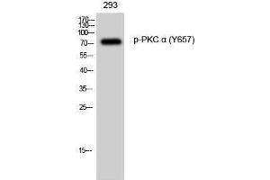 Western Blotting (WB) image for anti-Protein Kinase C, alpha (PKCa) (pTyr657) antibody (ABIN3179536) (PKC alpha 抗体  (pTyr657))
