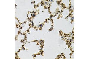 Immunohistochemistry of paraffin-embedded rat lung using IFI16 Antibody (ABIN6291165) at dilution of 1:100 (40x lens). (IFI16 抗体)