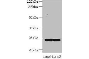Western blot All lanes: MRAP2 antibody at 7 μg/mL Lane 1: Mouse brain tissue Lane 2: Mouse kidney tissue Secondary Goat polyclonal to rabbit IgG at 1/10000 dilution Predicted band size: 24 kDa Observed band size: 24 kDa (MRAP2 抗体  (AA 66-205))