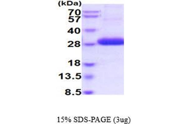 ULBP2 Protein (AA 26-216) (His tag)