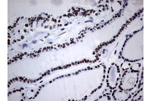 Image no. 1 for anti-Nibrin (NBN) (AA 183-460) antibody (ABIN1491056) (Nibrin 抗体  (AA 183-460))