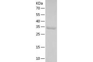 PDXP Protein (AA 1-296) (His tag)