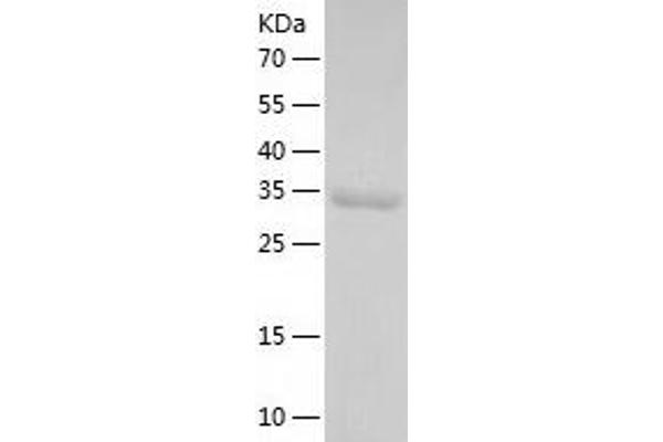 PDXP Protein (AA 1-296) (His tag)