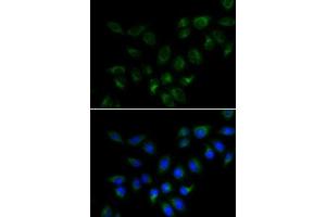 Immunofluorescence analysis of MCF7 cells using BMP15 antibody (ABIN6127524, ABIN6137593, ABIN6137594 and ABIN6223163). (BMP15 抗体  (AA 143-392))