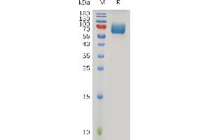 IFNAR2 Protein (AA 27-243) (Fc Tag)