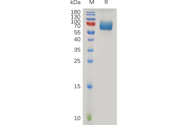 IFNAR2 Protein (AA 27-243) (Fc Tag)
