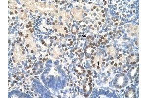 ZNF326 antibody was used for immunohistochemistry at a concentration of 4-8 ug/ml to stain Epithelial cells of renal tubule (arrows) in Human Kidney. (ZNF326 抗体  (C-Term))