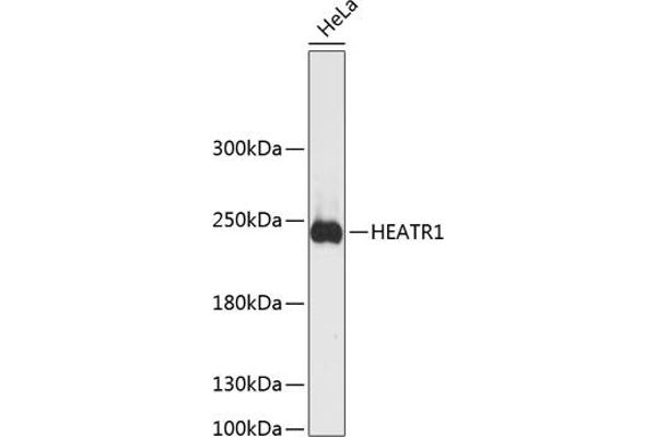 HEATR1 抗体  (AA 1-120)