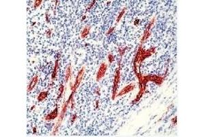 Formalin fixed paraffin embedded human tonsil stained with Factor VIII R antigen polyclonal  rabbit antibody (VWF 抗体)