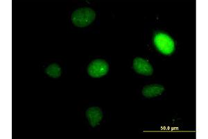 Immunofluorescence of monoclonal antibody to TBX2 on HeLa cell. (TBX2 抗体  (AA 603-702))