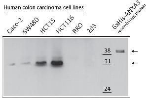 Western Blotting (WB) image for anti-Annexin A3 (ANXA3) antibody (ABIN2703592) (Annexin A3 抗体)
