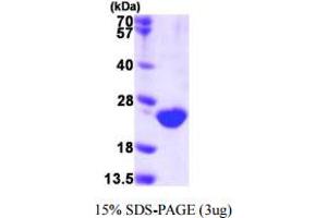 Dual Specificity Phosphatase 3 (DUSP3) (AA 1-185) protein (His tag)