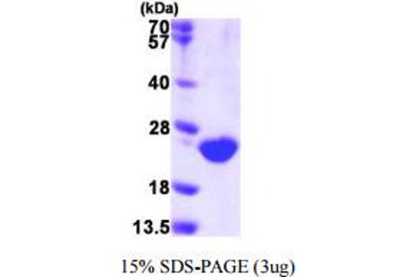 Dual Specificity Phosphatase 3 (DUSP3) (AA 1-185) protein (His tag)