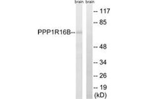 Western blot analysis of extracts from mouse brain cells, using PPP1R16B Antibody. (PPP1R16B 抗体  (AA 364-413))