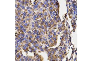 Immunohistochemistry (IHC) image for anti-Ribosomal Protein L5 (RPL5) antibody (ABIN1874650) (RPL5 抗体)