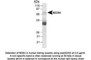 Image no. 1 for anti-NADPH Oxidase 4 (NOX4) (AA 100-200) antibody (ABIN363602) (NADPH Oxidase 4 抗体  (AA 100-200))